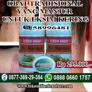 Illustration for article titled OBAT TRADISIONAL YANG MANJUR UNTUK EKSIM KERING